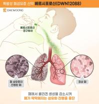 대웅제약, IDMC 안전성 인정....폐섬유증 신약 개발 청신호