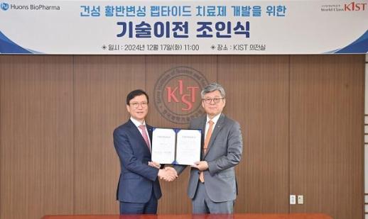  휴온스바이오파마‧KIST, 건성 황반변성 점안치료제 개발 기술협약 체결