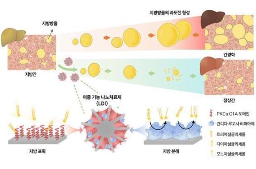 지방간 정복 길 열렸다... 간 손상 84% 줄인 신물질 탄생