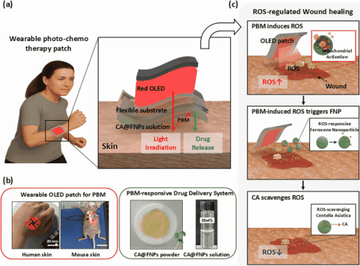 S. Korean researchers develop smart OLED patch to accelerate wound healing speed