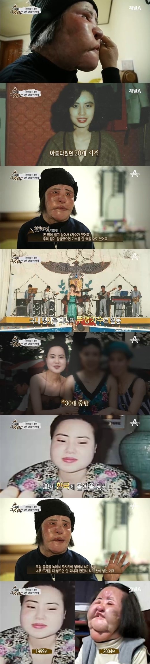 韩国整形失败 风扇大妈 年轻时代靓照大曝光 韩国整形失败 风扇大妈 年轻时代靓照大曝光