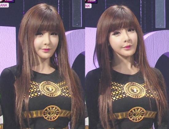 2ne1朴春面部不自然被疑整容失败