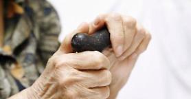 Positive results for Alzheimers therapy study in Sweden