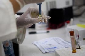 Australian researchers found a way to test Parkinsons