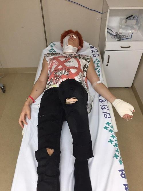 U-KISS member Kiseop injured in explosion of music video set