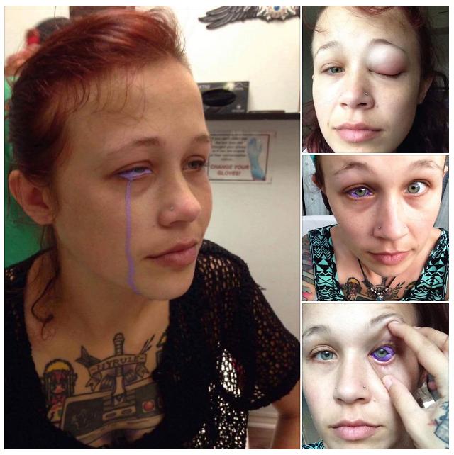Canadian Model tattooed her eyeball purple but she may get permanently blind