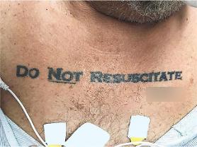 Unconscious man with Do Not Resuscitate tattoo passes away and sparks debate among doctors