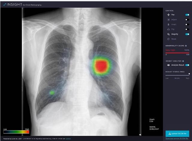 Lunit partners with IT firm to commercialize medical image detection assistant software