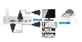 Medical wireless smart glasses start commercial sales in S. Korea