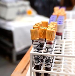 엄마아빠는 B형인데 나는 AB형?!  