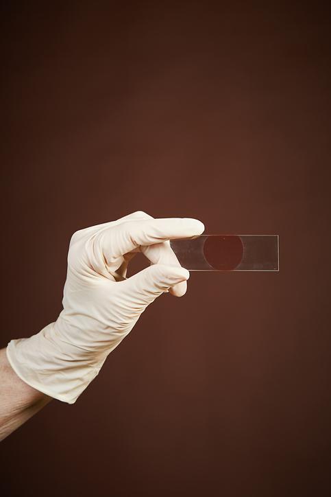 SK hynix uses CMOS image sensors for in vitro diagnostic equipment