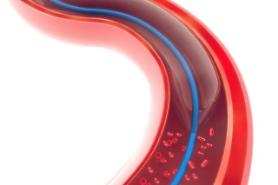 State researchers embark on development of biodegradable stent for digestive systems