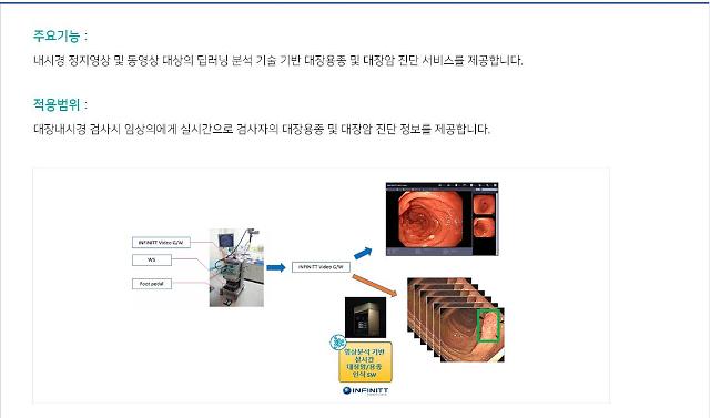 S. Korean hospital opens colonofiberscope center installed with AI medical software