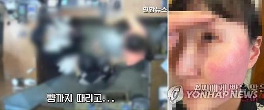 [아주 정확한 팩트체크] 폭행 논란 벨기에 대사 부인, 형사처벌 불가능?