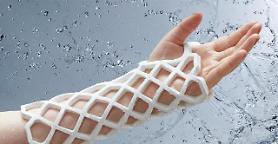 Mesh-type open cast receives high patient satisfaction: survey