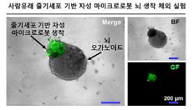 Researchers develop microrobot designed to deliver stem cells via intranasal pathway