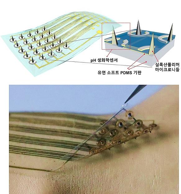 Researchers develop microneedle medical sensor technology for artery disease diagnosis