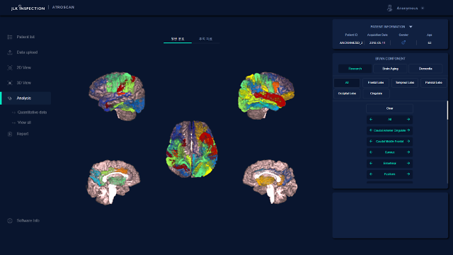 ​JLKs AI brain image analysis solution wins approval from Thai health department 