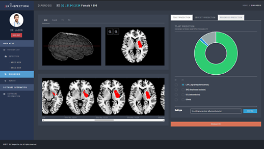 JLKs AI cerebral infarction analysis solution adopted by university hospital