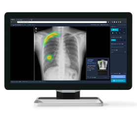 Brazilian hospital adopts Lunits AI chest X-ray solution 