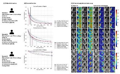 Researchers develop AI solution capable of predicting cardiovascular events for stroke patients