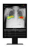 State-run police hospital adopts Lunits AI chest X-ray solution