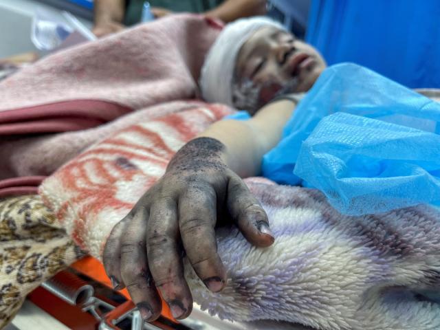 팔레스타인 무장 정파 하마스와 이스라엘 간 무력 충돌이 지속되는 가운데 10월 15일현지시간 가자지구 한 병원에서 이스라엘 공습으로 다친 한 소년이 누워있다 사진로이터 연합뉴스