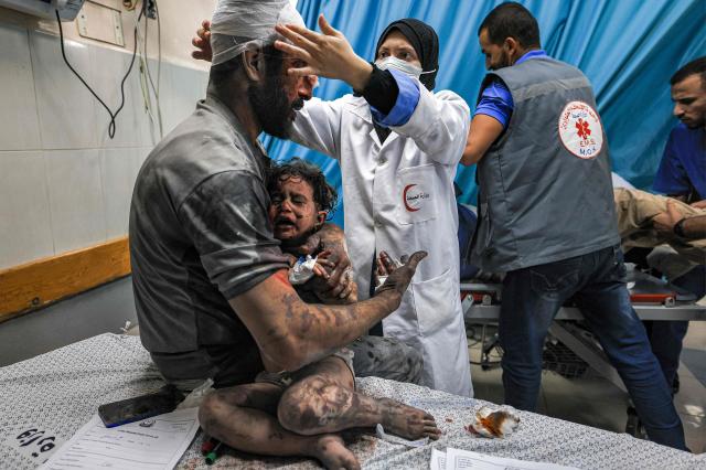 10월 24일현지시간 가자지구 남부 칸 유니스에 있는 나세르 병원에서 한 남성이 아이를 안고 있다 사진AFP 연합뉴스
