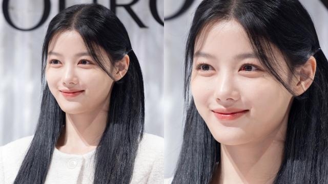 [슬라이드 포토] 김유정, 실핏줄터져도 러블리