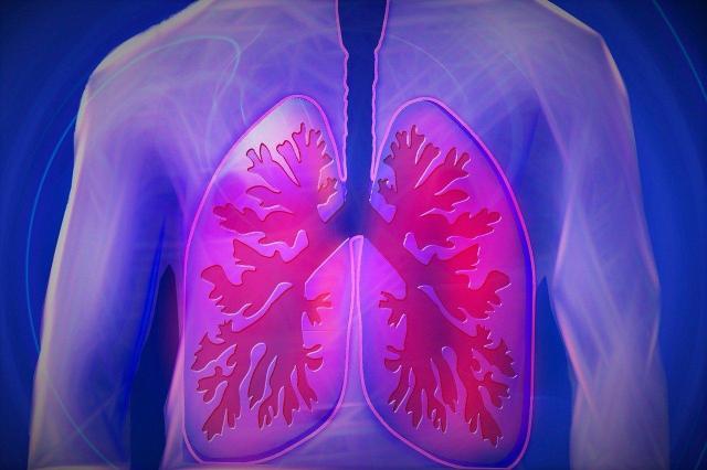 결핵은  주로 폐에 감염을 일으켜 폐결핵일 확률이 높다사진pixabay