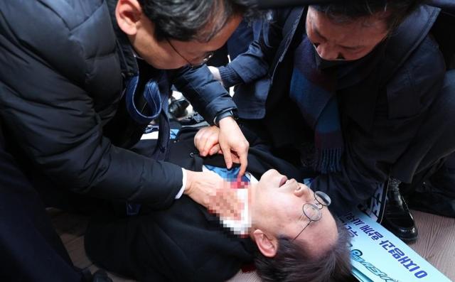 이재명 더불어민주당 대표가 지난 2일 피습당했다 사진연합뉴스
