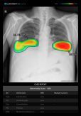 Samsung Electronics to integrate Lunits AI solutions into X-ray devices  