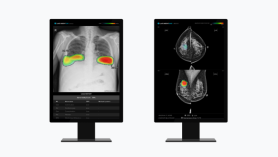 Lunit to provide AI solution for breast cancer to Singaporean hospital  