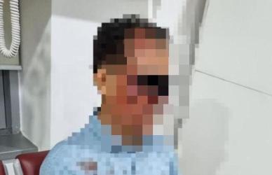 피부 찢어지고 코 골절…택시기사 폭행한 50대 男