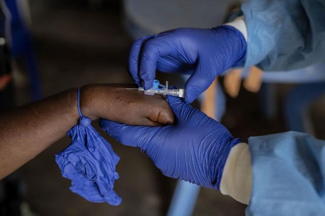 A health worker attends to a mpox patient at a treatment center in Munigi eastern Congo on Aug 16 2024 AP-Yonhap