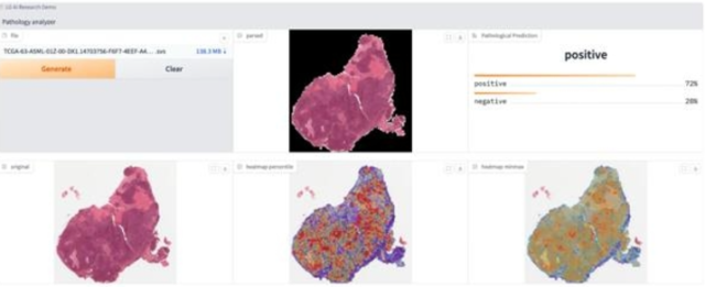 LG AI Research develops method to slash cancer diagnosis time