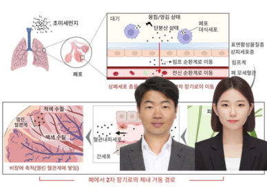 초미세먼지, 비장까지 간다...면역계 영향 새 실마리