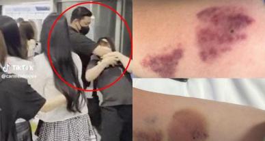 아이돌 과잉 경호 피해자 등판... 전치 4주 진단 사진 보니