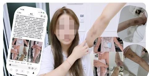 홍대서 중국 남성이 대만 여성 유튜버 폭행…경찰 내사 착수