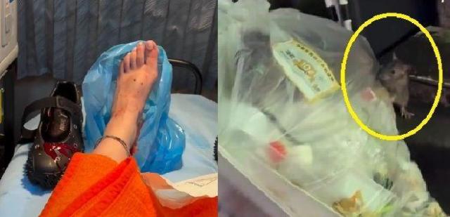 신주쿠에서 쥐에 물려 치료 받은 관광객 사진인스타그램 yogitutty 캡처