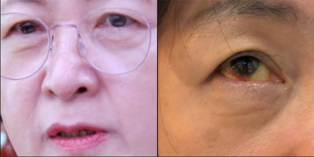 국회 법제사법위원회 위원장 추미애 더불어민주당 의원이 폭언과 조롱 막말이 오가며 파행을 거듭했던 법사위 국정감사가 끝나고 건강 이상 증세를 지난 3일 호소했다 사진추미애 더불어민주당 의원 페이스북