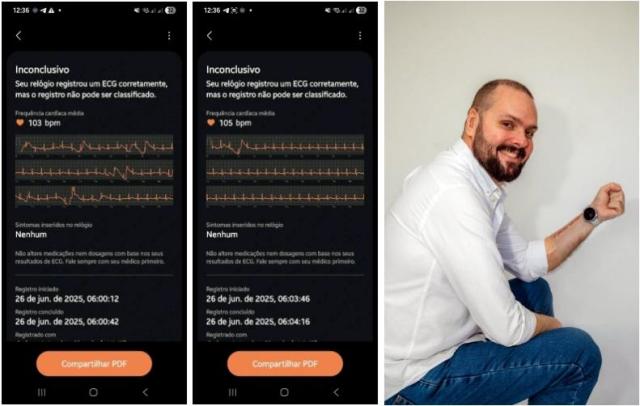 갤럭시 워치 착용한 호베르투 갈라르트오른쪽와 그의 심전도 측정 데이터 사진연합뉴스