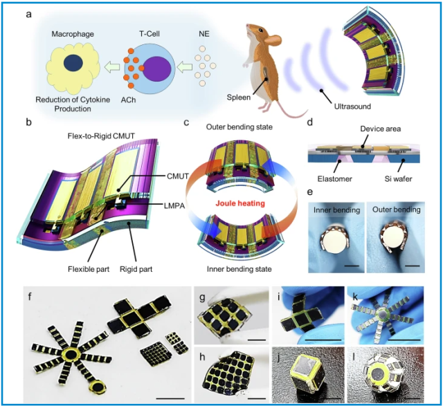 KAIST develops flexible ultrasound sensor that can diagnose and treat without surgery