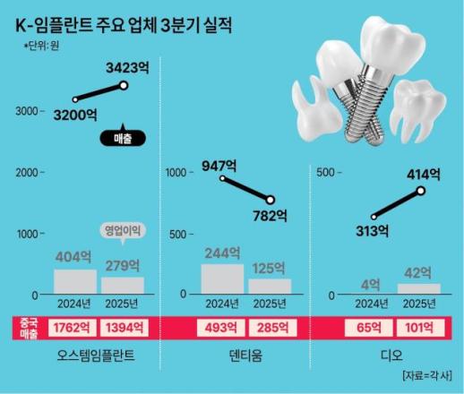 中 실적에 희비… 임플란트업계, 엇갈린 성적표