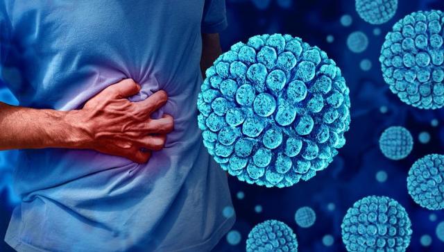 식중독 이미지 사진게티이미지뱅크