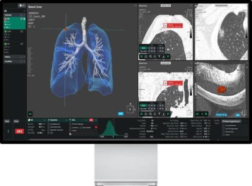 Coreline Soft đưa nền tảng chẩn đoán lồng ngực bằng trí tuệ nhân tạo AVIEW LCS Plus vào thị trường Việt Nam