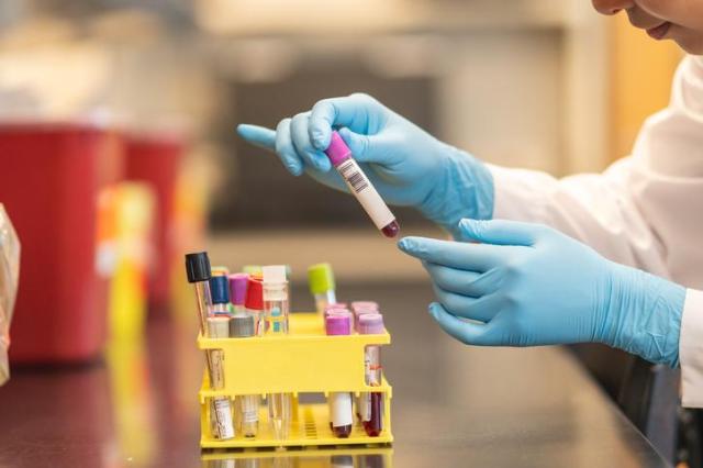 Kookmin University researchers turn cancers hunger against itself to treat drug-resistant tumors