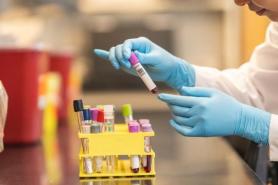 Kookmin University researchers turn cancers hunger against itself to treat drug-resistant tumors