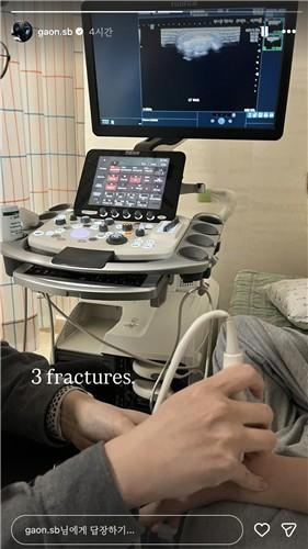 2026ミラノ：ハーフパイプ金メダルのチェ・ガオン、3箇所骨折診断