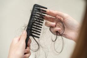 Hair-Loss Drug Market Grows as Companies Race to Develop Longer-Lasting Treatments